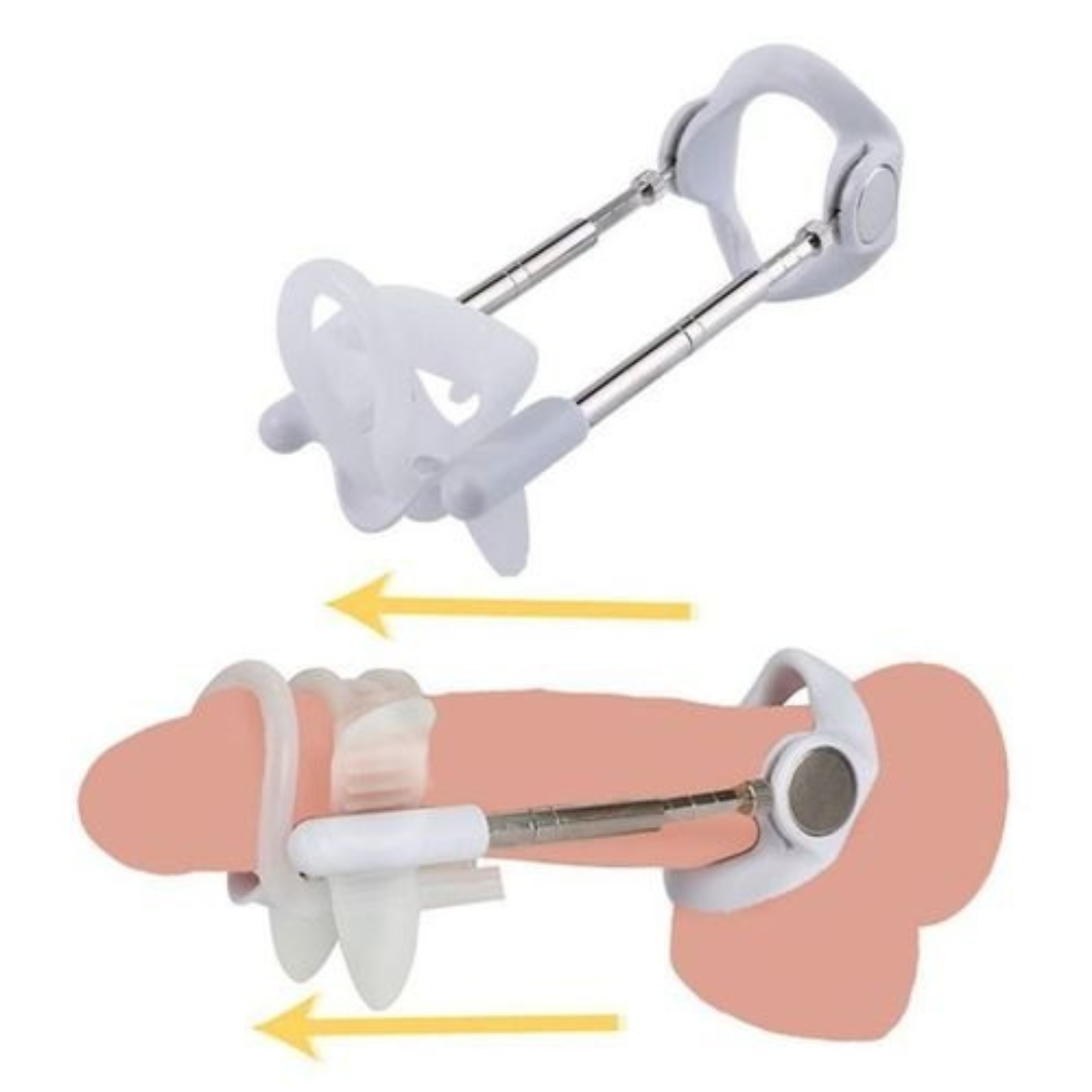 Pro Extender Penis Enlargement System - Image 3