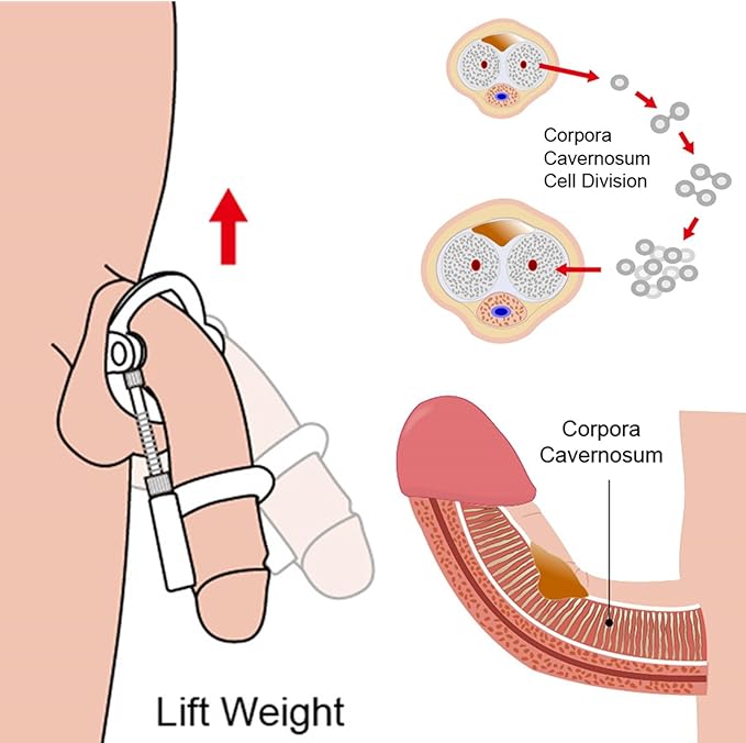 Pro Extender Penis Enlargement System - Image 6